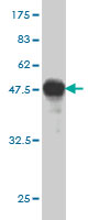 Antibody Reactive Against Recombinant Protein.Western Blot detection against Immunogen (36.74 KDa) . 