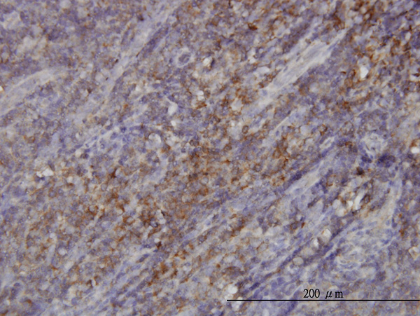 Immunoperoxidase of monoclonal antibody to RASGRP4 on formalin-fixed paraffin-embedded human tonsil. [antibody concentration 3 ug/ml]