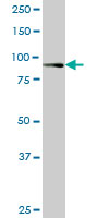 RASEF monoclonal antibody (M02), clone 1E3. Western Blot analysis of RASEF expression in A-431 ( (Cat # AT3577a )