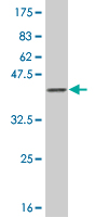 Antibody Reactive Against Recombinant Protein.Western Blot detection against Immunogen (37.73 KDa) . 