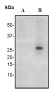 A. Western blot analysis on Jurkat cell lysates using anti-phosho FADD (pS194) RabMAb (Cat. #AJ1284b), 1:500 dilution. Cells were either (A) untreated (B) treated with calyculin A