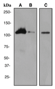 A. Western blot analysis on (A) HL-60 + Retinoic acid (B) HL-60 cell lysates and (C) Human thymus lysate using anti-RIAM RabMAb (Cat. #AJ1689a), dilution 1:2000.