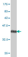 Antibody Reactive Against Recombinant Protein.Western Blot detection against Immunogen (37.29 KDa) . 