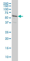 RALGPS2 monoclonal antibody (M01), clone 3F1 Western Blot analysis of RALGPS2 expression in HeLa ( (Cat # AT3557a )