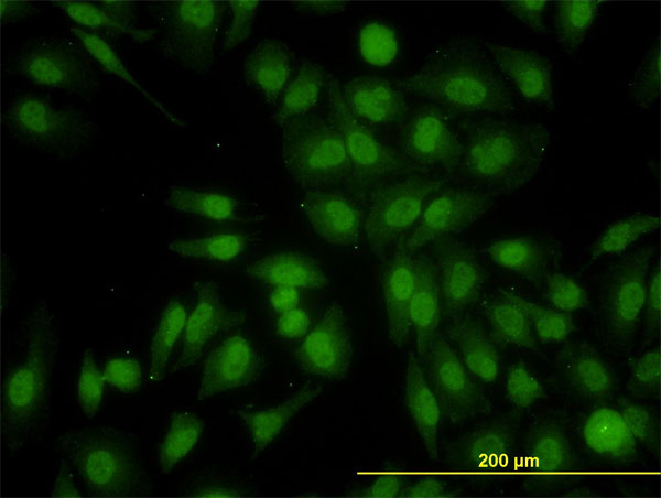 Immunofluorescence of monoclonal antibody to RALGPS2 on HeLa cell. [antibody concentration 10 ug/ml]