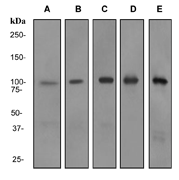 Western blot analysis on (A) Human Lymph node (B) Fetal brain (C) human spleen (D) Jurkat and (E) HL-60 + retinoic acid cell lysates using anti-RIAM RabMAb (Cat. #AJ1689b).