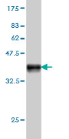 Antibody Reactive Against Recombinant Protein.Western Blot detection against Immunogen (37.73 KDa) . 
