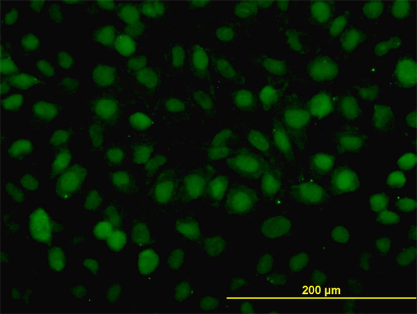 Immunofluorescence of monoclonal antibody to RAD54B on HeLa cell. [antibody concentration 10 ug/ml]