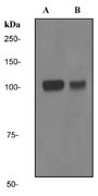 A. Western blot analysis on (A) fetal brain tissue lysate and (B) Jurkat cell lysate using anti-INPP4A RabMAb (Cat. #AJ1406a).