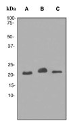 Western blot analysis on (A) fetal brain, (B) Neuro-2a and (C) SH-SY5Ycell lysates using anti-BM88 RabMAb (Cat. #AJ1102b).