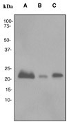 Western blot analysis on (A) fetal brain, (B) U87-MG and (C) Neuro-2a cell lysates using anti-BM88 RabMAb (Cat. #AJ1102a).