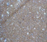 Immunohistochemical analysis of paraffin-embedded human brain tissue using anti-BM88 RabMAb (Cat. #AJ1102a).