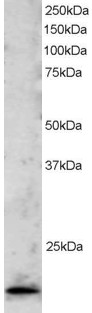 AF2070a staining (2 µg/ml) of Jurkat lysate (RIPA buffer, 30 µg total protein per lane). Primary incubated for 1 hour. Detected by western blot using chemiluminescence.