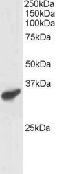 AF1935a staining (1 µg/ml) of Human Heart lysate (RIPA buffer, 30 µg total protein per lane). Primary incubated for 1 hour. Detected by western blot using chemiluminescence.