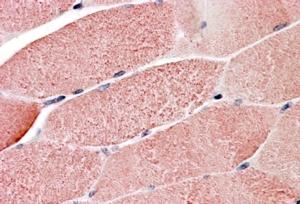 AF1487a (3.8 µg/ml) staining of paraffin embedded Human Skeletal Muscle. Steamed antigen retrieval with citrate buffer pH 6, AP-staining.