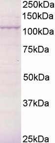 AF1145a (0.5 µg/ml) staining of Mouse Kidney epithelial cells lysate (15 µg protein in RIPA buffer). Primary incubation was 1 hour. Detected by chemiluminescence.