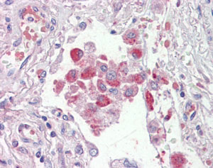 AF2379a (2.5 µg/ml) staining of paraffin embedded Human Lung. Steamed antigen retrieval with citrate buffer pH 6, AP-staining.