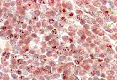 AF2296a (3.8 µg/ml) staining of paraffin embedded Human Liver. Steamed antigen retrieval with citrate buffer pH 6, HRP-staining.