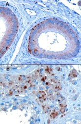 AF2153a staining of paraffin embedded Human Testis showing A) Epithelial cells of the epididymis and B) Some leydig cells. Microwaved antigen retrieval with A)Tris/EDTA buffer pH9 at 3 µg/ml or B)Citrate buffer pH6 at 10ug/ml., HRP-staining.