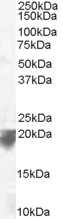 AF2152a staining (0.1 µg/ml) of Human Spleen lysate (RIPA buffer, 35 µg total protein per lane). Primary incubated for 1 hour. Detected by western blot using chemiluminescence.