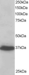 AF1808a staining (0.2 µg/ml) of A431 lysate (RIPA buffer, 35 µg total protein per lane). Primary incubated for 1 hour. Detected by western blot using chemiluminescence.