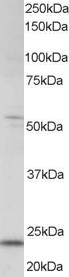 AF1645a staining (0.5 µg/ml) of human kidney lysate (RIPA buffer, 35 µg total protein per lane). Primary incubated for 1 hour. Detected by western blot using chemiluminescence.