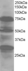 AF1631a staining (1 µg/ml) of Human Lung lysate (RIPA buffer, 30 µg total protein per lane). Primary incubated for 1 hour. Detected by western blot using chemiluminescence.