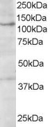 AF1539a (1 µg/ml) staining of A431 lysate (35 µg protein in RIPA buffer). Primary incubation was 1 hour. Detected by chemiluminescence.
