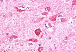 AF1733a (5 µg/ml) staining of paraffin embedded Human Cerebral Cortex. Steamed antigen retrieval with citrate buffer pH 6, AP-staining.