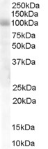 AF1540a staining (1 µg/ml) of Human Lung lysate (RIPA buffer, 30 µg total protein per lane). Primary incubated for 1 hour. Detected by western blot using chemiluminescence.