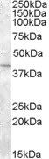 AF1998a (2 µg/ml) staining of Mouse Eye lysate (35 µg protein in RIPA buffer). Primary incubation was 1 hour. Detected by chemiluminescence.
