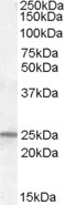 AF1818a (0.1 µg/ml) staining of Human Kidney lysate (35 µg protein in RIPA buffer). Primary incubation was 1 hour. Detected by chemiluminescence.