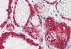AF1627a (2.5 µg/ml) staining of paraffin embedded Human Thyroid Gland. Steamed antigen retrieval with citrate buffer pH 6, AP-staining.
