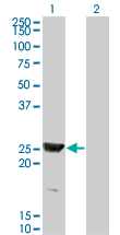 Western Blot analysis of RAB15 expression in transfected 293T cell line by RAB15 monoclonal antibody (M01), clone 1G12.Lane 1: RAB15 transfected lysate(23.5 KDa).Lane 2: Non-transfected lysate.