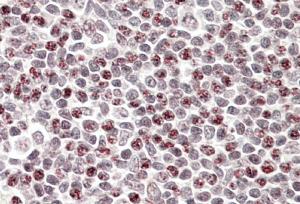 AF2685a (3.8 µg/ml) staining of paraffin embedded Human Tonsil. Steamed antigen retrieval with citrate buffer pH 6, AP-staining.