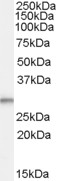 AF2102a (0.1 µg/ml) staining of Human Breast Cancer lysate (35 µg protein in RIPA buffer). Primary incubation was 1 hour. Detected by chemiluminescence.