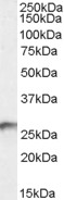 AF1148a (0.3 µg/ml) staining of Human Kidney lysate (35 µg protein in RIPA buffer). Primary incubation was 1 hour. Detected by chemiluminescence.
