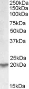 AF2139a (0.03 µg/ml) staining of Human Kidney lysate (35 µg protein in RIPA buffer). Primary incubation was 1 hour. Detected by chemiluminescence.