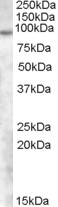 AF2074a(1 µg/ml) staining of Human Skin lysate (35 µg protein in RIPA buffer). Primary incubation was 1 hour. Detected by chemiluminescence.