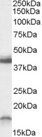 AF1905a (0.3 µg/ml) staining of Rat Brain lysate (35 µg protein in RIPA buffer). Primary incubation was 1 hour. Detected by chemiluminescence.