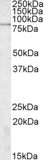 AF2188a (2 µg/ml) staining of A549 lysate (35 µg protein in RIPA buffer). Primary incubation was 1 hour. Detected by chemiluminescence.