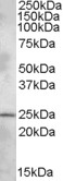 AF1823a (1 µg/ml) staining of Rat Brain lysate (35 µg protein in RIPA buffer). Primary incubation was 1 hour. Detected by chemiluminescence.