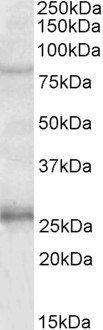 AF3271a (1 µg/ml) staining of Human Hippocampus lysate (35 µg protein in RIPA buffer). Primary incubation was 1 hour. Detected by chemiluminescence.