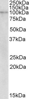 AF3143a (2 µg/ml) staining of Human Breast cancer lysate (35 µg protein in RIPA buffer). Primary incubation was 1 hour. Detected by chemiluminescence.