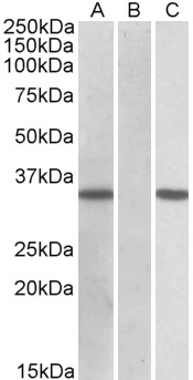 HEK293 lysate (10ug protein in RIPA buffer) overexpressing Human CRISP2 (RC205312) with C-terminal MYC tag probed with AF3120a (0.11ug/ml) in Lane A and probed with anti-MYC Tag (1/1000) in lane C. Mock-transfected HEK293 probed with AF3120a (1mg/ml) in Lane B. Primary incubations were for 1 hour. Detected by chemiluminescence.