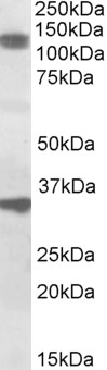 AF2225a (1 µg/ml) staining of Rat Skeletal Muscle lysate (35 µg protein in RIPA buffer). Primary incubation was 1 hour. Detected by chemiluminescence.