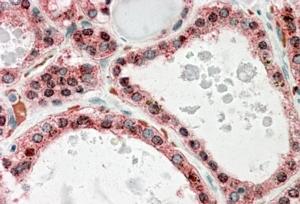 AF2211a (3.8 µg/ml) staining of paraffin embedded Human Thyroid Gland. Steamed antigen retrieval with citrate buffer pH 6, AP-staining.