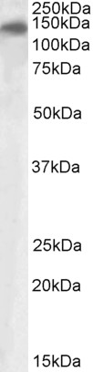 AF2208a (1 µg/ml) staining of Human Ileum lysate (35 µg protein in RIPA buffer). Primary incubation was 1 hour. Detected by chemiluminescence.