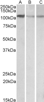 AF3538a (0.1 µg/ml) staining of NIH3T3 (A), Mouse Brain (B) and Rat Brain (C) lysates (35 µg protein in RIPA buffer). Primary incubation was 1 hour. Detected by chemiluminescence.