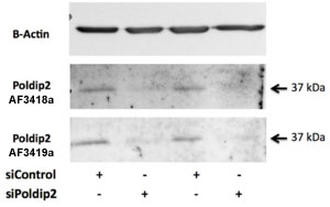 AF3418a (0.5 µg/ml) staining of Rat VSMC lysate (35 µg protein in RIPA buffer). Primary incubation was overnight at 4C. Detected by chemiluminescence. Data provided by Everest Grant winner Dr. B. Lassegue, Emory University, Atlanta, USA